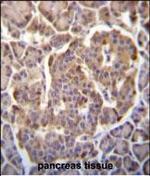 PIK3CB Antibody in Immunohistochemistry (Paraffin) (IHC (P))