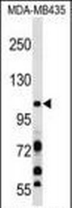 PIK3CB Antibody in Western Blot (WB)