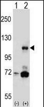 PIK3CB Antibody in Western Blot (WB)
