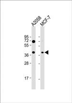 GNA12 Polyclonal Antibody