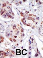 PIP4K2C Polyclonal Antibody
