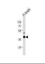 PIP4K2C Antibody in Western Blot (WB)