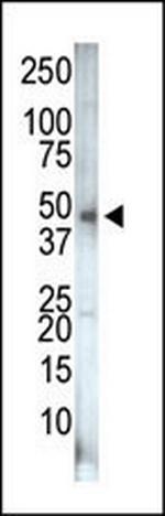 PIP4K2C Antibody in Western Blot (WB)
