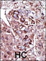 DGKZ Antibody in Immunohistochemistry (Paraffin) (IHC (P))