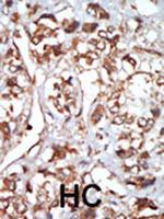HRI Polyclonal Antibody