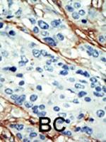 ARK5 Polyclonal Antibody