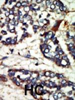 NEK1 Antibody in Immunohistochemistry (Paraffin) (IHC (P))
