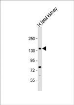 NEK1 Antibody in Western Blot (WB)