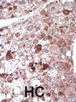 PCK1 Polyclonal Antibody