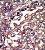 PRKAR1A Polyclonal Antibody
