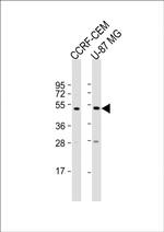 PRKAR1A Antibody in Western Blot (WB)