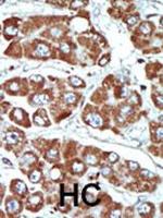 SIK1 Polyclonal Antibody