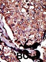 DGKB Polyclonal Antibody