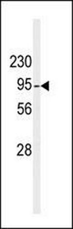 DGKB Antibody in Western Blot (WB)