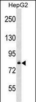 DGKB Antibody in Western Blot (WB)