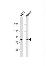 DGKA Antibody in Western Blot (WB)