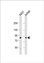 DGKA Polyclonal Antibody