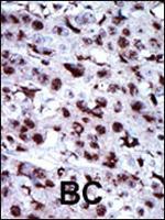 Adenylate Kinase 5 Polyclonal Antibody