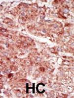 HK3 Polyclonal Antibody