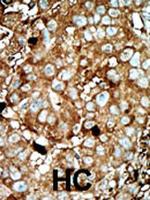 PFKFB3 Polyclonal Antibody