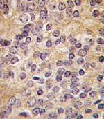 Urokinase Antibody in Immunohistochemistry (Paraffin) (IHC (P))