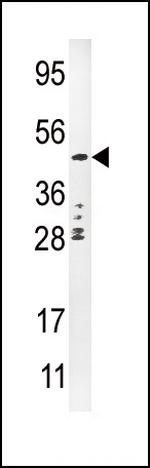 Urokinase Antibody in Western Blot (WB)