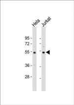 PTP1B Polyclonal Antibody