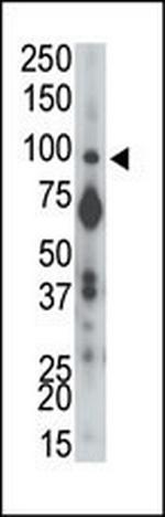 PTPRA Polyclonal Antibody