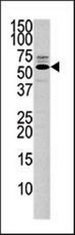 PTEN Antibody in Western Blot (WB)
