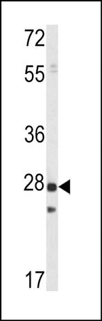 PRL1 Polyclonal Antibody