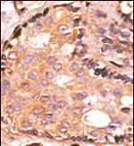 MKP2 Polyclonal Antibody