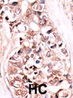 DUSP14 Polyclonal Antibody