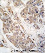 CTDSP2 Antibody in Immunohistochemistry (Paraffin) (IHC (P))