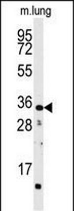 CTDSP2 Antibody in Western Blot (WB)
