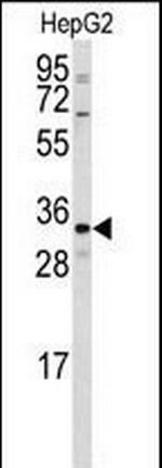 CTDSP2 Antibody in Western Blot (WB)