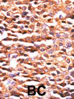 PP2A alpha Polyclonal Antibody