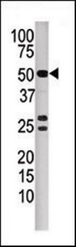 PPP3CB Antibody in Western Blot (WB)