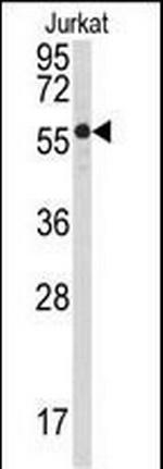 PPP3CB Antibody in Western Blot (WB)