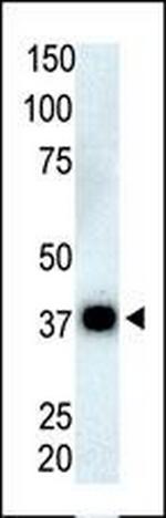 PPP6C Antibody in Western Blot (WB)