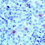 Cyclin B1 Antibody in Immunohistochemistry (IHC)