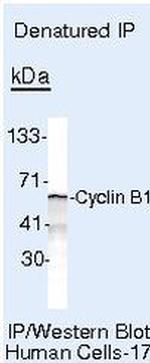 Cyclin B1 Antibody in Immunoprecipitation (IP)