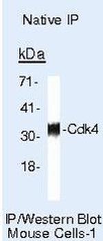 Cyclin D1 Antibody in Immunoprecipitation (IP)