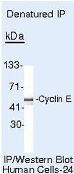 Cyclin E Antibody in Immunoprecipitation (IP)