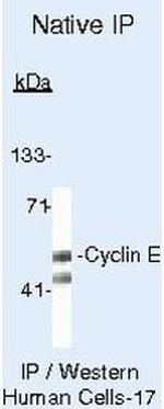 Cyclin E Antibody in Immunoprecipitation (IP)