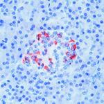 Somatostatin Antibody in Immunohistochemistry (IHC)