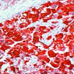 S100 Antibody in Immunohistochemistry (IHC)