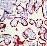 hCG beta Antibody in Immunohistochemistry (Paraffin) (IHC (P))