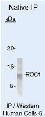 ROC1 Antibody in Immunoprecipitation (IP)