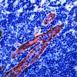 CD31 Antibody in Immunohistochemistry (Paraffin) (IHC (P))
