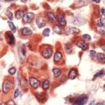 COX1 Antibody in Immunohistochemistry (IHC)